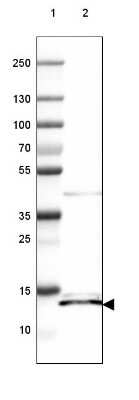 Western Blot: ISCU Antibody [NBP2-38829]