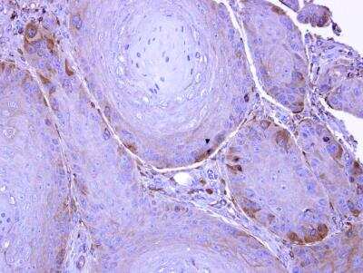Immunohistochemistry-Paraffin: ISG15 Activating Enzyme/UBE1L Antibody [NBP1-32579]