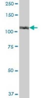 Western Blot: ISG15 Activating Enzyme/UBE1L Antibody [H00007318-B01P]