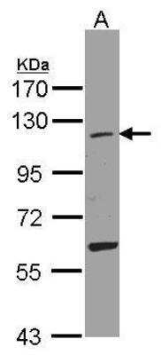 Western Blot: ISG15 Activating Enzyme/UBE1L Antibody [NBP1-32579]