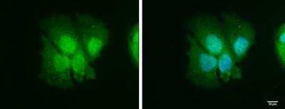 Immunocytochemistry/ Immunofluorescence: ISG15/UCRP Antibody [NBP2-16995]