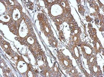 Immunohistochemistry-Paraffin: ISG15/UCRP Antibody [NBP2-16995]