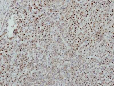 Immunohistochemistry-Paraffin: ISG20 Antibody [NBP2-16996]