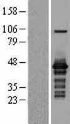 Western Blot: ISG20L2 Overexpression Lysate [NBL1-12049]