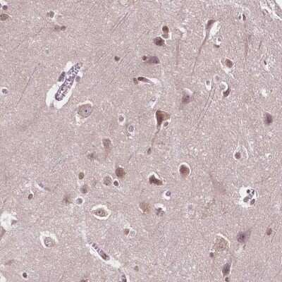 Immunohistochemistry: ISLR-2 Antibody [NBP2-49515]