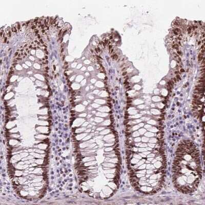 Immunohistochemistry-Paraffin: ISLR-2 Antibody [NBP2-48522]