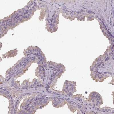 Immunohistochemistry-Paraffin: ISLR Antibody [NBP2-14131]