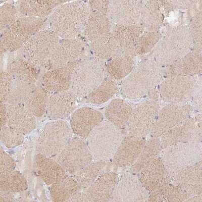 Immunohistochemistry-Paraffin: ISLR Antibody [NBP2-14131]