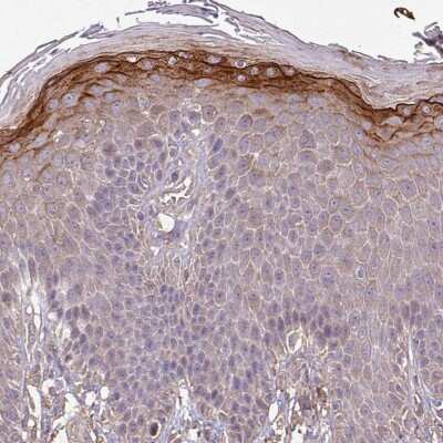 Immunohistochemistry-Paraffin: ISLR Antibody [NBP2-14131]