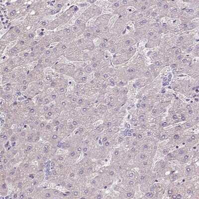 Immunohistochemistry-Paraffin: ISLR Antibody [NBP2-14131]