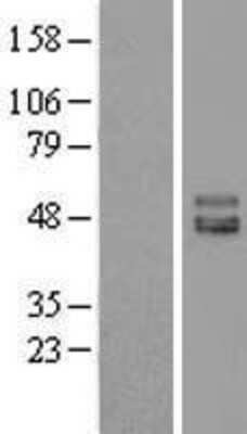 Western Blot: ISLR Overexpression Lysate [NBL1-12051]