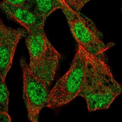 Immunocytochemistry/ Immunofluorescence: ISM2 Antibody [NBP1-82001]