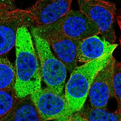 Immunocytochemistry/ Immunofluorescence: ISOC1 Antibody [NBP2-56038]