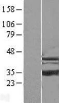 Western Blot: ISOC1 Overexpression Lysate [NBL1-12053]