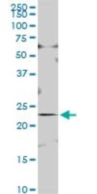 Western Blot: ISOC2 Antibody [H00079763-B01P]