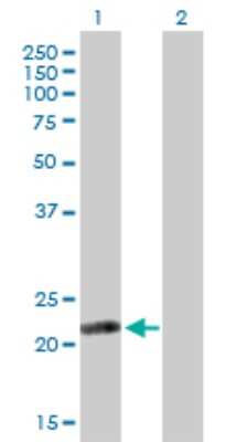 Western Blot: ISOC2 Antibody [H00079763-B01P]