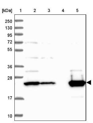 Western Blot: ISOC2 Antibody [NBP1-82074]
