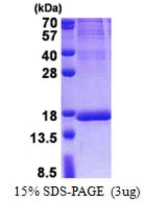 SDS-PAGE: Recombinant Human ISOC2 His Protein [NBP2-23153]