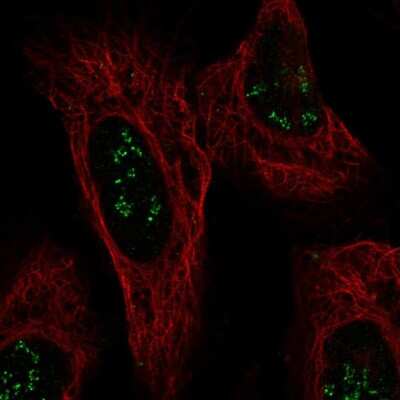 Immunocytochemistry/ Immunofluorescence: ISPD Antibody [NBP2-58091]