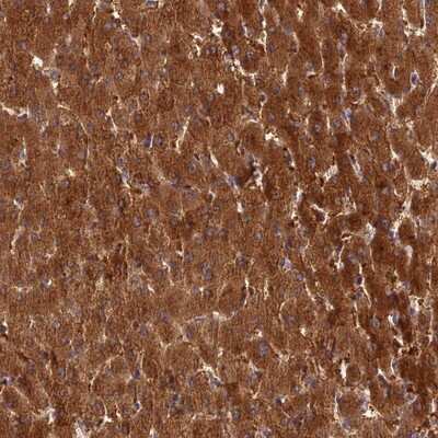 Immunohistochemistry-Paraffin: ISPD Antibody [NBP1-92030]