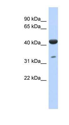 Western Blot: ISPD Antibody [NBP1-79722]