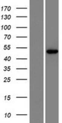 Western Blot: ISPD Overexpression Lysate [NBP2-09338]