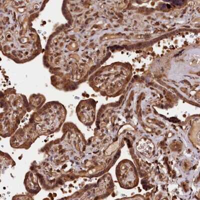 Immunohistochemistry-Paraffin: IST1 Antibody [NBP1-87676]