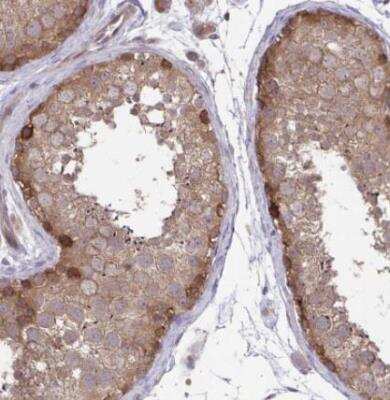 Immunohistochemistry-Paraffin: IST1 Antibody [NBP2-33720]