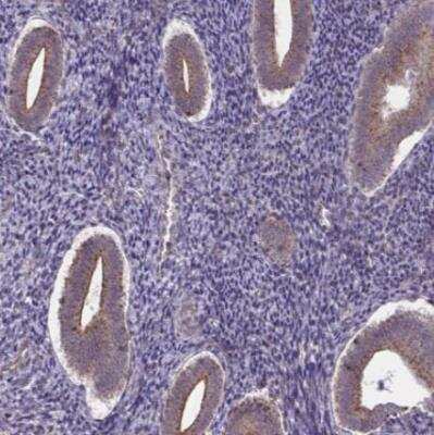 Immunohistochemistry-Paraffin: IST1 Antibody [NBP2-33720]