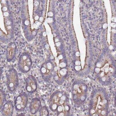 Immunohistochemistry-Paraffin: IST1 Antibody [NBP2-33720]