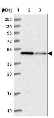 Western Blot: IST1 Antibody [NBP1-87676]
