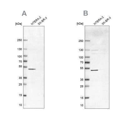 Western Blot: IST1 Antibody [NBP2-33720]