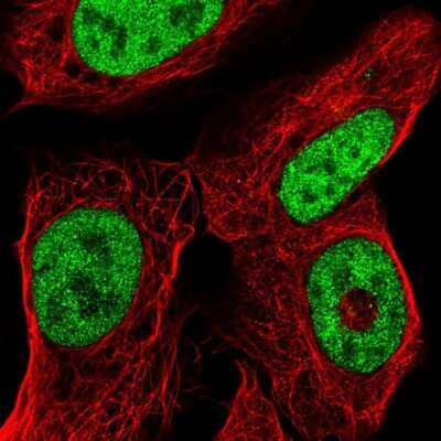 Immunocytochemistry/ Immunofluorescence: ISX Antibody [NBP2-32531]