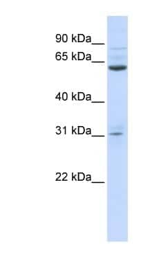 Western Blot: ISX Antibody [NBP1-79216]