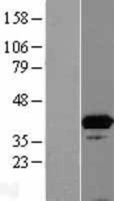 Western Blot: ISY1 Overexpression Lysate [NBL1-12055]