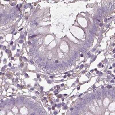 Immunohistochemistry-Paraffin: ISYNA1 Antibody [NBP2-47415]