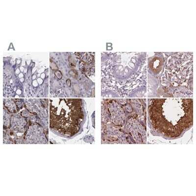 Immunohistochemistry-Paraffin: ISYNA1 Antibody [NBP2-48513]