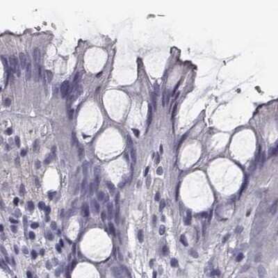 Immunohistochemistry-Paraffin: ISYNA1 Antibody [NBP2-48513]