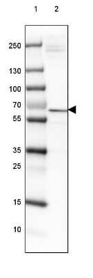 Western Blot: ISYNA1 Antibody [NBP2-47415]