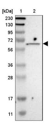 Western Blot: ISYNA1 Antibody [NBP2-48513]