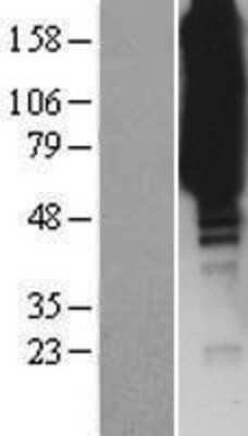 Western Blot: ISYNA1 Overexpression Lysate [NBP2-07041]