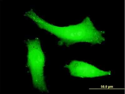 Immunocytochemistry/ Immunofluorescence: ITCH/AIP4 Antibody (1B8) [H00083737-M06]