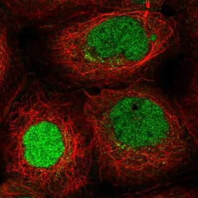 Immunocytochemistry/ Immunofluorescence: ITCH/AIP4 Antibody [NBP2-55083]