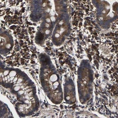 Immunohistochemistry-Paraffin: ITCH/AIP4 Antibody [NBP1-89180]