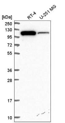 Western Blot: ITCH/AIP4 Antibody [NBP2-55083]