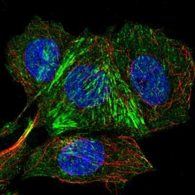 Immunocytochemistry/ Immunofluorescence: ITF46 Antibody [NBP2-55728]