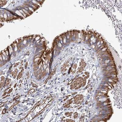 Immunohistochemistry-Paraffin: ITF46 Antibody [NBP1-89910]