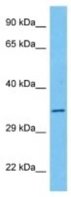 Western Blot: ITF46 Antibody [NBP3-10129]