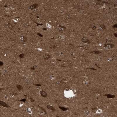Immunohistochemistry-Paraffin: ITFG1 Antibody [NBP1-85735]