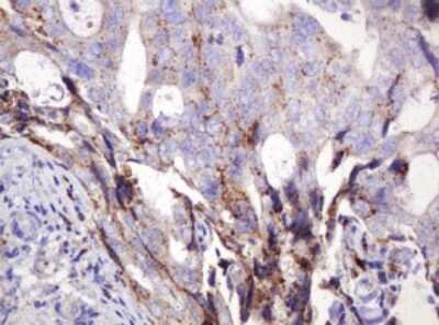 Immunohistochemistry: ITFG3 Antibody (OTI3B3) [NBP2-45766]